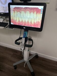 Introduction Every smile has a starting point. For some, it begins with curiosity. For others, it starts with a mirror moment, a quiet decision to change something that has always been slightly off. Today, that journey looks very different from it did years ago. No wires. No brackets. Just a carefully designed path that fits into your daily routine. This is not just about straightening teeth. It is about movement, precision, consistency, and trust in a system that works quietly in the background of your life. From the first digital scan to the moment you see your final results, the Invisalign braces journey is structured, predictable, and surprisingly personal. The First Step: Seeing the Future Before It Begins Before anything moves, everything is mapped. Your journey starts with a detailed scan that captures every angle of your teeth. This is not guesswork. It is a digital blueprint. Using advanced planning tools, your dentist creates a step-by-step simulation of how your teeth will shift over time. You are not just told what will happen. You are shown. That moment, when you see your future smile on screen, often changes everything. It turns uncertainty into clarity. Aligners That Work Quietly in the Background Once your plan is finalized, your aligners are created with precision. Each set is designed to move your teeth slightly, almost imperceptibly. There is no dramatic shift overnight. Instead, there is steady, controlled progress. Each aligner builds on the last. Each phase brings you closer. What makes this system effective is consistency. Aligners should be worn at all times except during oral hygiene. That level of commitment is what keeps your progress on track. Living With Aligners: Subtle Changes, Real Progress At first, the changes are small. You may notice slight pressure. You may feel a difference in how your teeth come together. These are signs that movement has started. Over time, those small changes become visible. Edges begin to align. Spacing improves. Your smile starts to look more balanced. This is where patience becomes important. The process is designed to work gradually, allowing your teeth and surrounding structures to adjust safely. The Learning Curve: Getting Comfortable With Removal For many people, the early days come with one unexpected challenge. Removing aligners. It sounds simple, but the first few attempts can feel unfamiliar. You might experience pain when removing Invisalign in the initial days. This is usually temporary and linked to the pressure your teeth are adjusting to. Understanding how to remove Invisalign without pain becomes an important part of your routine. Here are a few simple Invisalign aligner removal tips for beginners: Start from the back teeth and gently lift the aligner Avoid pulling from the front first Use slow, even pressure instead of force Keep your hands steady and relaxed If your trays feel snug, you might wonder how to take off tight Invisalign trays. The key is patience, not strength. Gradual loosening works better than sudden pulling. In some cases, Invisalign removal can cause tooth sensitivity. This is usually short-lived and improves as your teeth adapt. Progress Checkpoints: Staying on Track Every few weeks, your progress is reviewed. These visits are not long or complicated, but they are important. They ensure that your teeth are moving as planned. If adjustments are needed, they are made early. This keeps your journey smooth and predictable. It is not about rushing. It is about staying aligned with the plan. The Midpoint: When Changes Become Noticeable There comes a point when the changes are no longer subtle. You start seeing the difference in photos. You notice it when you smile. Others begin to see it too. This stage often boosts motivation. It reminds you that the effort is working. But it is also where consistency matters the most. Skipping wear time or becoming irregular can slow progress. The system works best when you stay committed. The Final Phase: Bringing Everything Together As you move into the final sets of aligners, the focus shifts from movement to refinement. Small adjustments are made to ensure your teeth settle into their ideal positions. This phase is about precision. It ensures your final result looks natural and balanced. Once complete, your teeth are where they need to be. But the journey does not end there. Retention: Protecting Your New Smile After your aligner phase is complete, retainers take over. Teeth do not instantly lock into place. They need time to stabilize. Retainers help maintain your results while everything settles. Wearing them as advised ensures that your progress stays intact. This step is often overlooked, but it is just as important as the treatment itself. Why This Journey Feels Different What sets this process apart is how seamlessly it fits into everyday life. There are no major interruptions. No dramatic changes to your routine. You continue your day as usual while your teeth gradually shift in the background. It is structured, but flexible. Controlled, but comfortable. And most importantly, it is designed around you. Common Experiences Along the Way Every journey comes with small moments of adjustment. These are not setbacks. They are part of how the process works and often a sign that everything is moving in the right direction. You may notice slight pressure when switching to a new aligner. This feeling usually lasts for a day or two and simply means your teeth are responding to the next phase of movement. It is a controlled shift, not something sudden or harmful. You may experience temporary sensitivity, especially as your teeth adjust to a new set. This can make everyday actions feel slightly different at first, but it typically settles quickly as your mouth adapts. In some cases, this sensitivity may be more noticeable during removal, especially in the early stages. Experiences like pain when removing Invisalign or mild discomfort are common and tend to improve over time. You may also need a few days to get used to the removal techniques. At the beginning, aligners can feel snug, and figuring out how to remove Invisalign without pain takes a bit of practice. Following simple Invisalign aligner removal tips for beginners, such as starting from the back and using gentle pressure, can make the process much smoother. If your trays feel firm, understanding the best way to take off tight Invisalign trays can help you avoid unnecessary discomfort. Some people also notice that tooth sensitivity from Invisalign removal becomes less frequent as they move further into their treatment. This is because your teeth gradually adapt to the routine of movement and removal. All of these experiences are normal. They are part of your body, adjusting to a structured and carefully planned process. Rather than being something to worry about, they are signs that your treatment is active, responsive, and progressing exactly as intended. Key Takeaways Your Invisalign journey is planned digitally before it begins Consistency in wearing aligners is the most important factor Initial discomfort or sensitivity is temporary and expected Learning proper removal techniques improves comfort Retainers are essential to maintain long-term results Invisalign removal causing tooth sensitivity FAQs How long does the Invisalign journey usually take? Most treatments range from 6 to 18 months, depending on the complexity of your case and consistency in wear. Is it normal to feel discomfort when removing aligners? Yes, especially in the beginning. Pain when taking Invisalign out is common but usually reduces as your teeth adjust. What helps reduce sensitivity during removal? Using gentle techniques and following Invisalign aligner removal tips for beginners can make the process smoother and more comfortable. Can tight aligners damage teeth when removing them? No, if removed correctly. The best way to take off tight Invisalign trays is to lift them slowly from the back teeth without force. Will sensitivity continue throughout the treatment? Sensitivity is usually temporary and occurs during aligner changes or early stages. Invisalign removal, which can cause tooth sensitivity, typically improves over time. Conclusion From your first scan to your final smile, this journey is built on precision, patience, and consistency. It does not demand dramatic changes to your lifestyle. Instead, it works quietly alongside it. Each step is intentional. Each phase is designed to bring you closer to a result that feels natural, balanced, and truly yours. The process may seem gradual, but that is exactly what makes it effective. Use Get Directions for step-by-step navigation We serve Santa Ana, Tustin, Tustin Foothills, Anaheim, Garden Grove, Placentia, Fullerton, Irvine, Yorba Linda, Fountain Valley, Westminster, Stanton, Costa Mesa, Brea, and Buena Park, California. We also proudly serve the City of Orange, the City of Irvine, the City of Villa Park, and the City of Anaheim Hills, along with our neighboring communities. Remember: Your results depend on consistency. Wearing your aligners as advised, following simple routines, and staying committed to the process will shape your outcome more than anything else. Small daily habits create lasting results. Disclaimer: This content is for informational purposes only and does not replace professional dental advice. Always consult your dental provider for guidance specific to your condition and treatment plan.