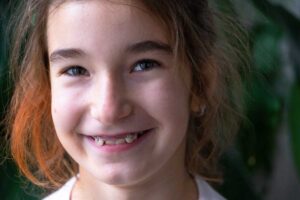 Palatal Expanders for Kids: Typical Duration and Care