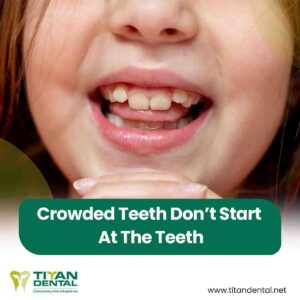Traditional vs. IPE Palatal Expanders: What Parents Need to Know